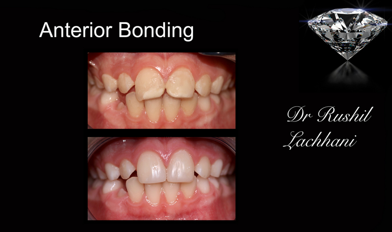 Gallery Headington NHS Dental Practice Oxford Cowley Gallery Headington NHS Dental Practice Oxford Cowley