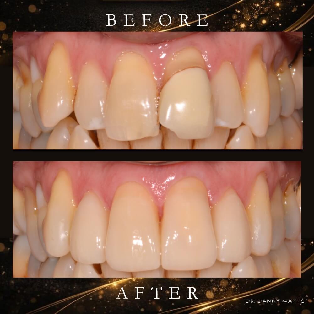 Before & After Results