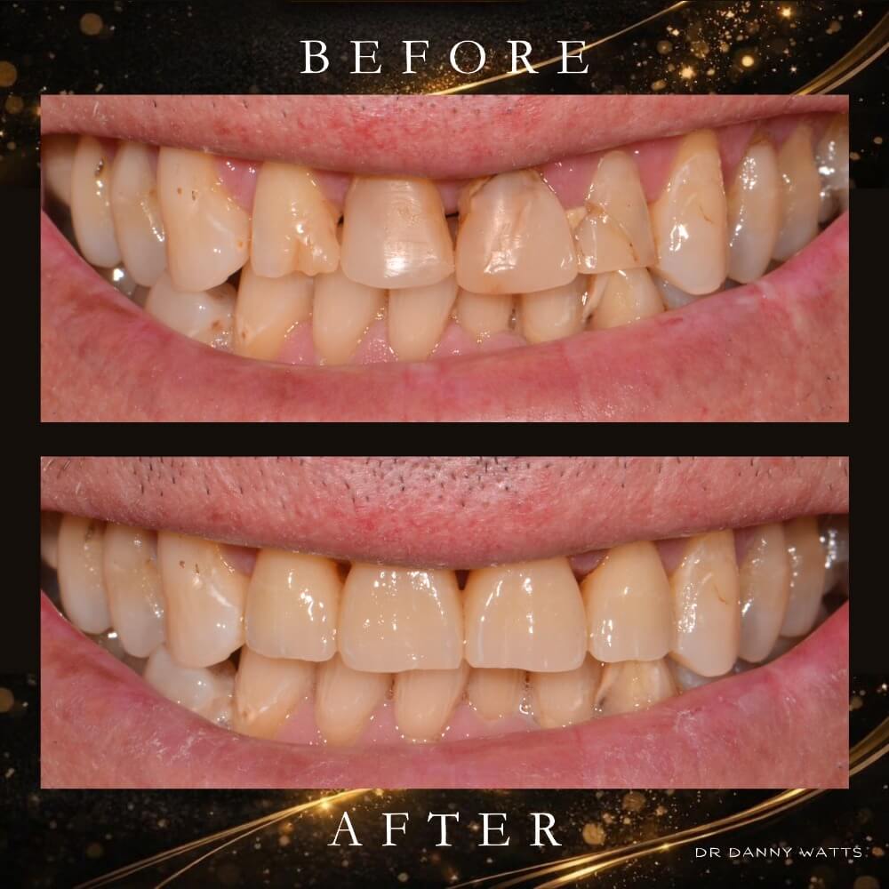 Before & After Results