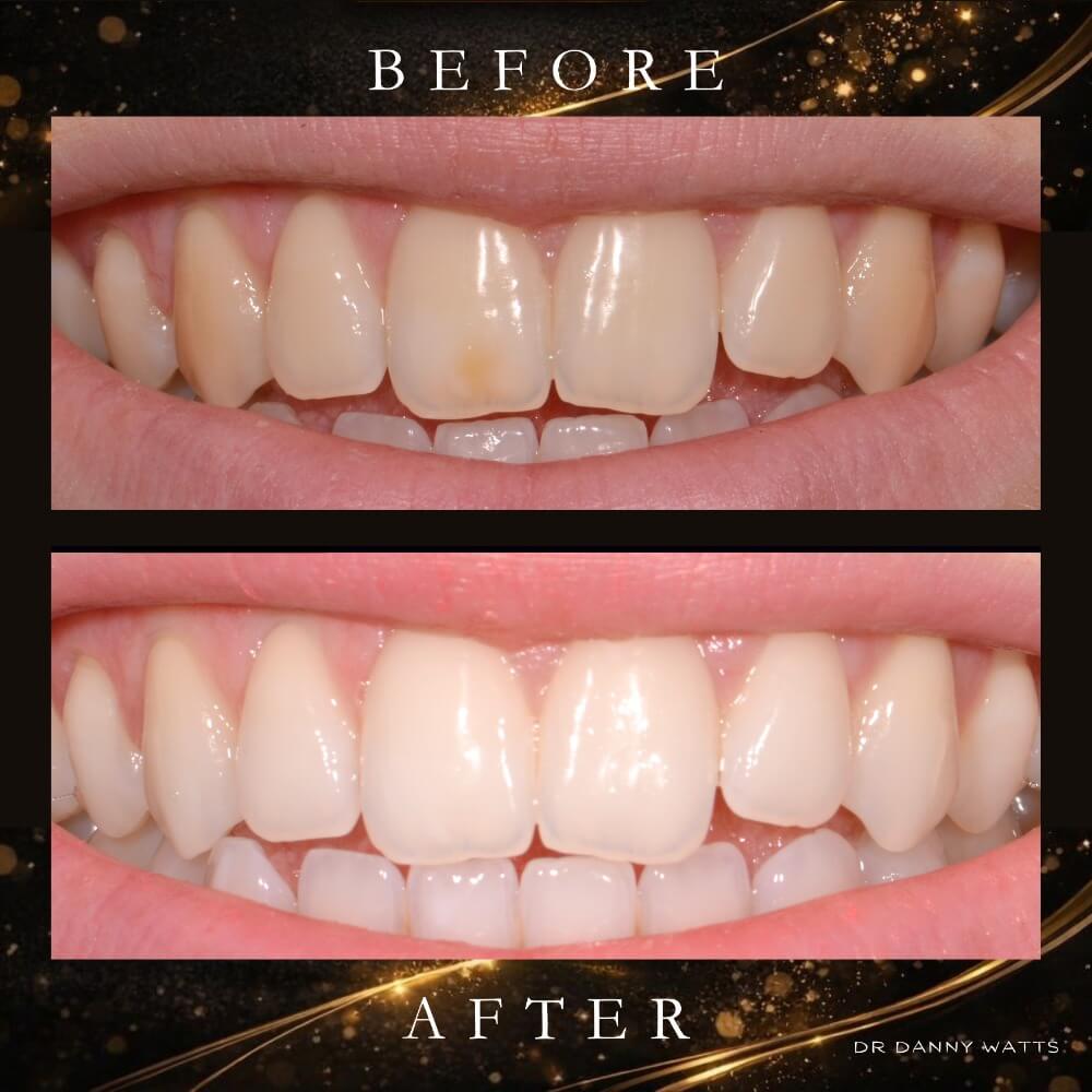 Before & After Results