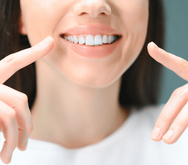 Dental Crowns in Headington