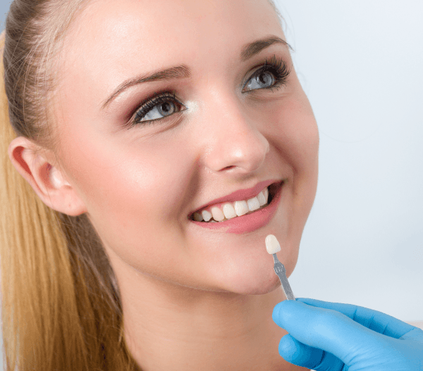 Dental Veneers in Headington